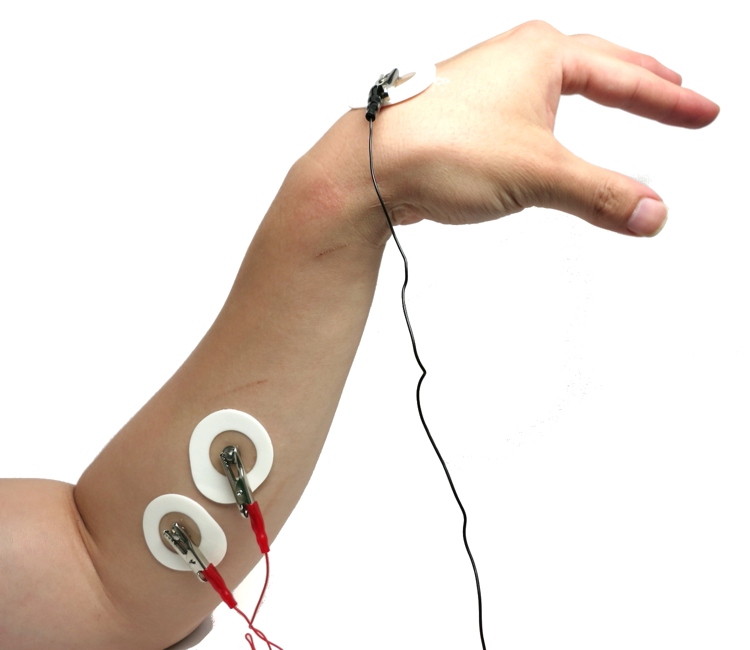 Place two EMG electrodes on the forearm, one on the back of the hand, and clip on the EMG cables using the alligator clips. Reds on the forearm muscle and black on the back of the hand.